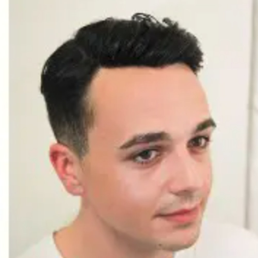 Roots Care client after: Crown density restored with a custom hair system
