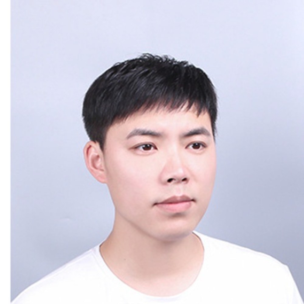Roots Care client after: Receding hairline rebuilt for a natural front