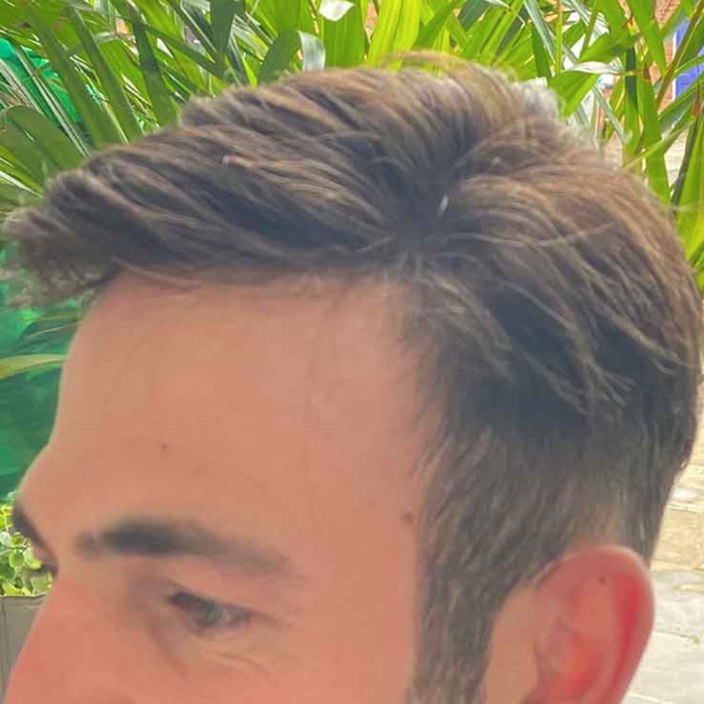 Roots Care client after: Full hair system, natural hairline