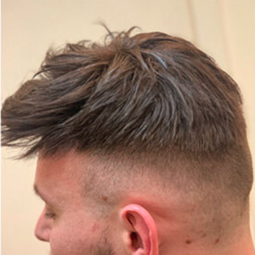 Roots Care client after: Crown coverage with textured styling